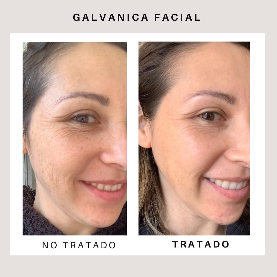 Sistema ageLOC® Galvanic Spa® 250