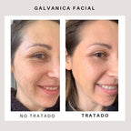 Sistema ageLOC® Galvanic Spa® 250