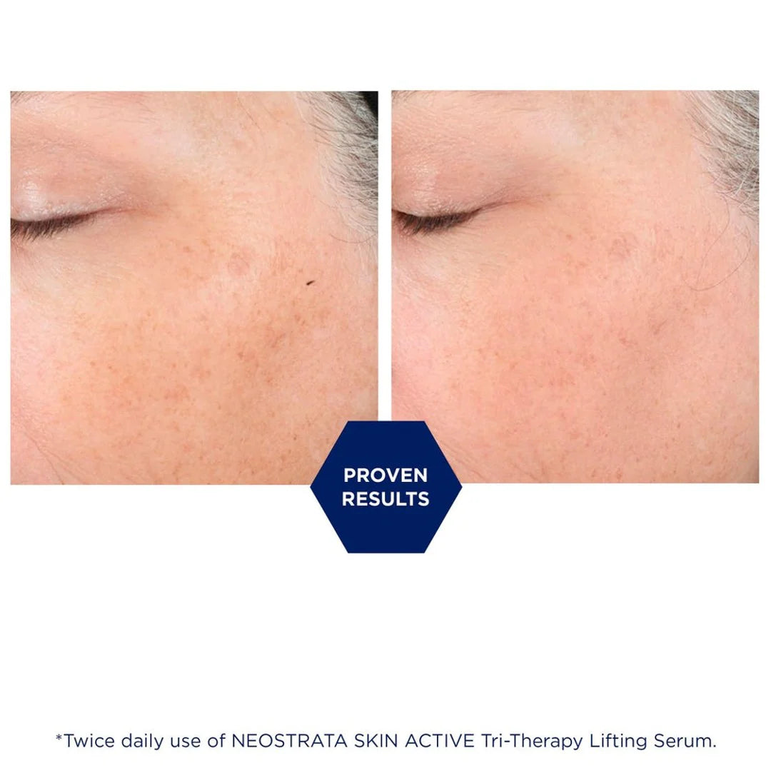 TRI THERAPY LIFTING SERUM- Serum reafirmante