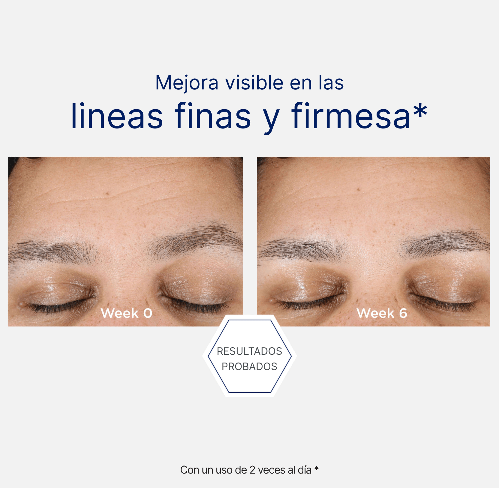 HYALURONIC LUMINOUS LIFT