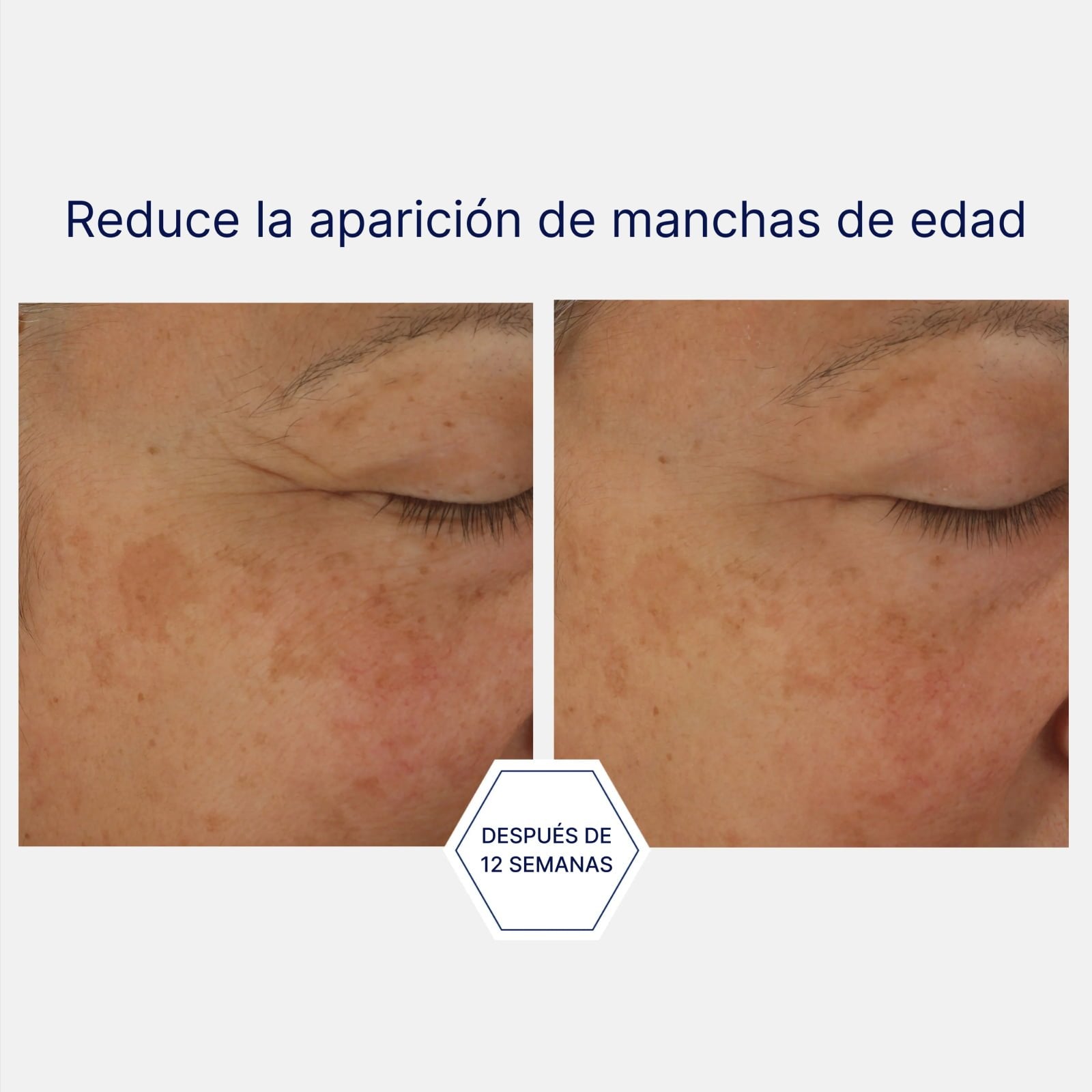 Potent Retinol Complex